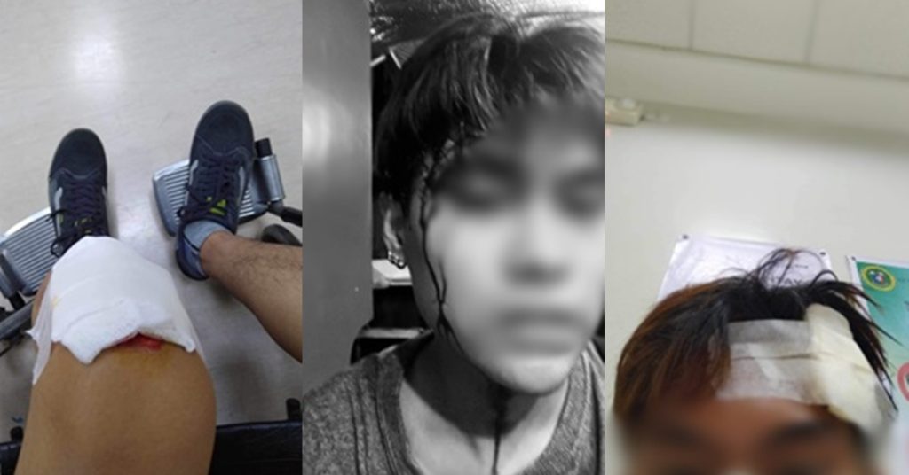 Just Want to Save Money but Student Fell Victim to Riding-in-tandem, and the Lesson He Shared on Social Media 5 thomas